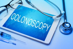 Colonoscopy